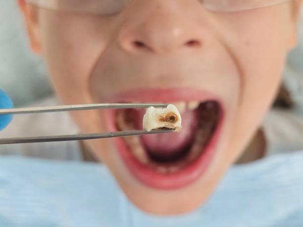 Best Broken Tooth Emergency  in River Heights, UT
